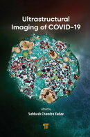 Ultrastructural Imaging of COVID-19