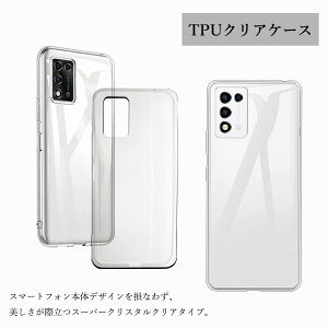 �u���[���C�g�J�b�g�t�B�����t��| XiaoMi Redmi Note17ProMax �P�[�X TPU ���� �N���A �X�}�z�P�[�X+�K���X �t�B�����t�� �X�}�z�J�o�[ �V���I�~ XiaoMi Redmi Note17Pro Max �X�}�z�J�o�[ �g�уP�[�X