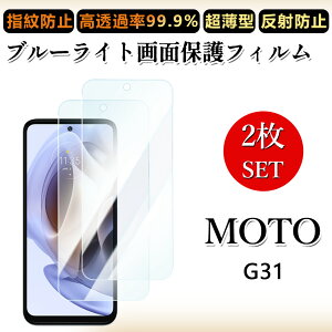 2 ���Z�b�g �u���[���C�g�J�b�g�t�B���� Moto G31 �t�B���� Moto G31 Moto G31 ���g���[�� g31g31�ڂɗD����/�����h�~/�C�A���X/�L�Y�C��/������/�h�w��~ �_�炩�� �t�B����