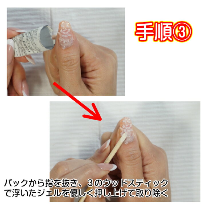 楽天市場 セルフ ネイル オフキット 5点セット ネイルオフセット ネイル ジェルネイル ネイルアート デコ ネイルオフ ネイルオフセット 自宅 ネイル セルフネイル セルフネイルオフ 自宅でケア 暮らし快適屋