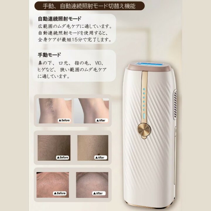 楽天市場】脱毛器 ハイパワー連射 ルピエ（LUPIE）高級サファイア 
