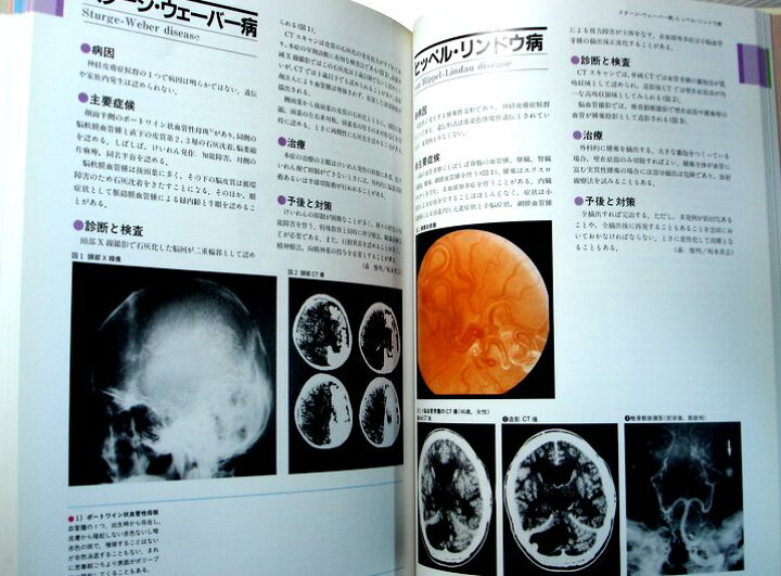 楽天市場】【中古】図説 臨床看護医学 第8巻 脳神経 : 63堂