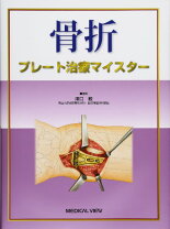 楽天市場】骨折髄内固定治療マイスターの通販