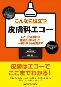 �y���i�z�y��񎞁A�[��1�`3�T�ԁz����Ȃɖ𗧂畆�ȃG�R�[�y���[���ւ�I���̏ꍇ���������z