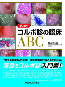 �y���i�z�y��񎞁A�[��1�`3�T�ԁz�R���|�f�̗Տ�ABC�y����E�����ȊO���������z