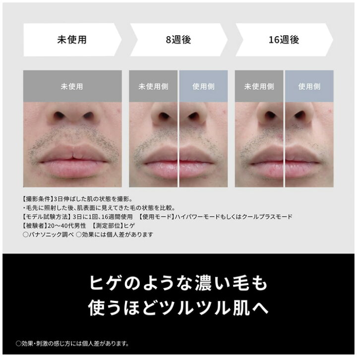 楽天市場】パナソニック 光エステ スムースエピ パワー＆クール ES 