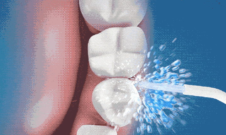 マウスウォッシャー Amazon.co.jp: 【2024新登場・2in1口腔洗浄器】ジェット