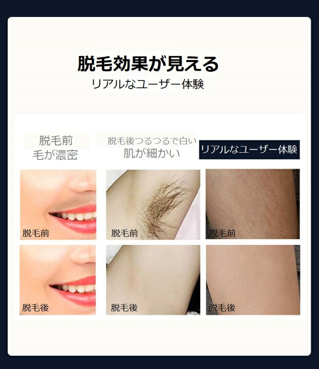 氷点脱毛器 Bp0804 脱毛器 家庭用 Cool 足 Hair System Ice Ipl ムダ毛処理 セルフ脱毛 脱毛機 光 Removal 自宅 脇 プレゼント 脱毛 除毛 腕 顔 美容機器 ギフト 背中 氷点脱毛器 Bp0804 脱毛器 家庭用 Cool 足 Hair System Ice Ipl ムダ毛処理 セルフ脱毛 脱毛機 光 Removal 自宅 脇 プレゼント 脱毛 除毛 腕 顔 美容機器 ギフト 背中