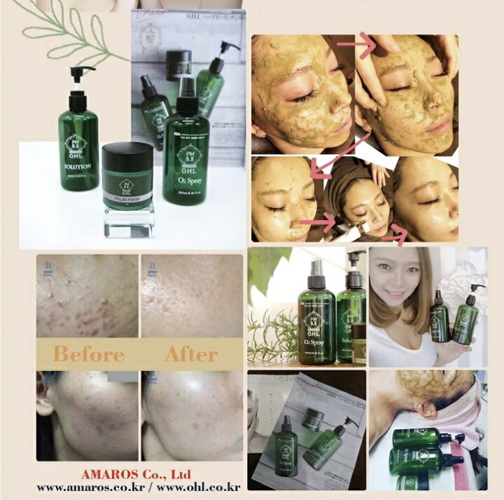 楽天市場】アマロス OHLハーブピーリングパウダー 容量20g(AMPパウダー  