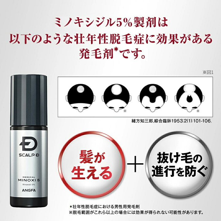 楽天市場】【第1類医薬品】スカルプD メディカルミノキ5 