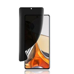 Xiaomi 14T / 14T Pro/Xiaomi Poco X7 Pro�`�����h�~�t�B�����y�K�C�h�g�t���zTPU�f�� �����h�~/�C�A���X/�L�Y�C��/�����h�~//�P�[�X�Ɋ����Ȃ�/�S�ʕی� Xiaomi 14T �ی�t�B�����y�w��F�ؑΉ� 1��