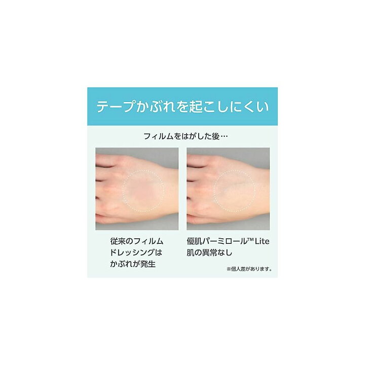 楽天市場】優肌パーミロールLite ロールタイプ 15cm×12m L34R15 1巻