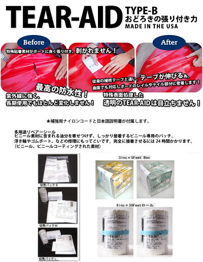 年最新海外 メーカーお取り寄せ 粘着力 防水性も抜群のリペアテープが登場 Tear Aid ティアエイド Roll Bタイプ 最先端 E Papers Gr 年最新海外 メーカーお取り寄せ 粘着力 防水性も抜群のリペアテープが登場 Tear Aid ティアエイド Roll Bタイプ 最先端 E Papers Gr