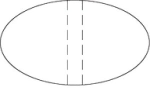 y ~߃V[ ~Vȉ~ LQ940S(500)z POPV[ ̔ bsO V[ Jh~ ZLeB g PET PP ARC nPET ܎~߃V[ ~ V[  n