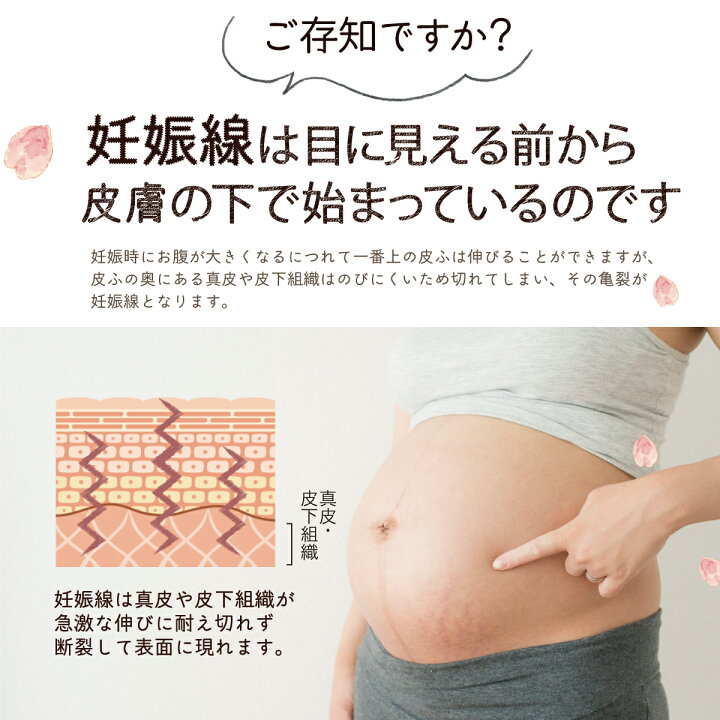 楽天市場 キラリボーテ 妊娠線クリーム レジストリル お母さん ママ マタニティ 跡 産後ケア 薄く 隠す 消す 出産後 皮膚 目立つ 臨月 美容 ボディクリーム でき始め 保湿 初期 肉割れ かゆい お腹 お尻 胸 脇 ボディケア マタニティグッズ 妊婦 ストレッチマーク きらり