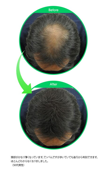 楽天市場 送料無料 マジックパウダー 50g ライトブラウン 薄毛隠し 薄毛カバー 薄毛対策 白髪隠し 白髪カバー 瞬間増毛 増毛 男女兼用 円形脱毛 クラウン Magic Powder スーパーミリオンヘアーをお使いの方に アトム屋美容本舗 美容専売品