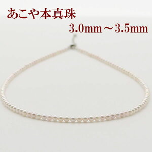 ^ p[ lbNX ^ p[lbNX 3mm-3.5mm xr[p[ zCgJ[ Vo[ AR{^ JWA