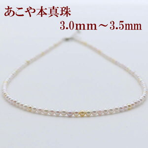 ^ p[ lbNX ^ p[lbNX 3mm-3.5mm }`J[ xr[p[ Vo[ AR{^ JWA