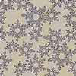 F-1474 ZO-̐̌ ^ NX}X