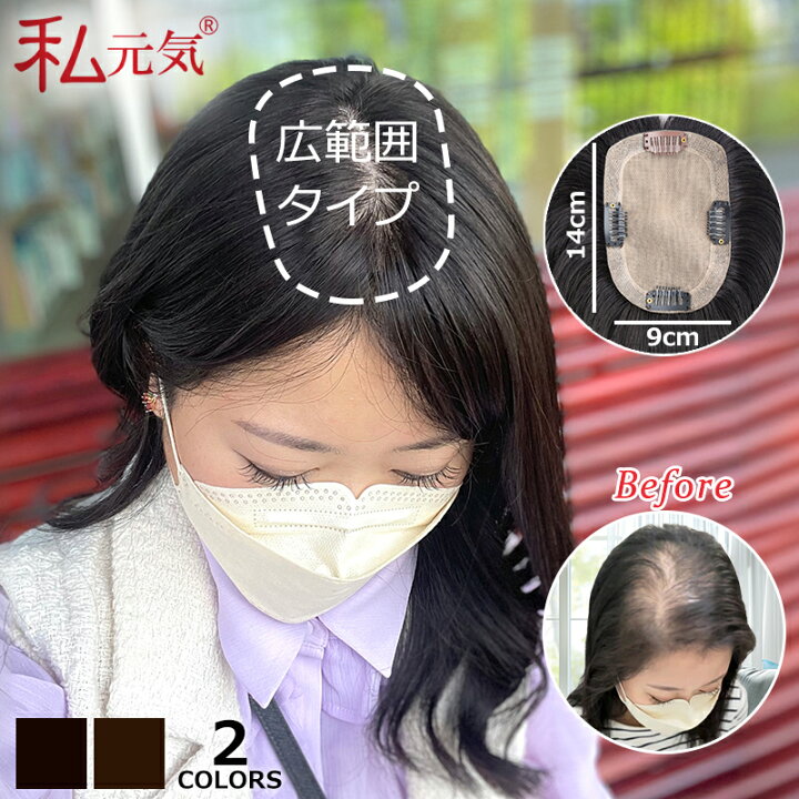 楽天市場】全国カット/返品無料 大面積 9×14cm 部分ウィッグ 頭頂部  