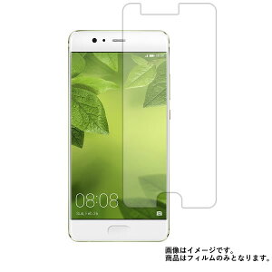 HUAWEI P10 Plus py  ڂɗD A`OA u[CgJbg ^Cv z t ی tB  t@[EFC s[ e vX