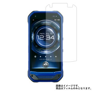 yX[p[SALE z 50OFFzTORQUE G03 au py ˖h~ }bg mtB[ ^Cv z t ی tB  gN W[[X[