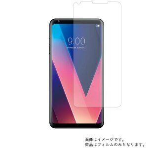 �y2���Z�b�g�zLG�G���N�g���j�N�X V30+ L-01K docomo �p�y �}�b�g ���˒ጸ �z�t�� �ی� �t�B���� �� �G���W�[ �h�R��