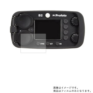 �y2���Z�b�g�z�v���t�H�g Profoto B2 Air TTL 901107 �p�y ���d�x 9H �A���`�O���A �^�C�v �z �t�� �ی� �t�B���� ���� �K���X�t�B���� �� ������ ���d�x9H �� �f�W�J�� �f�W�^���J���� �J���� �t�� ��
