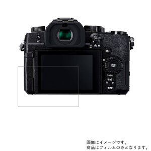 y2ZbgzPanasonic LUMIX G99 DC-G99 py dx u[CgJbg NA zt ی tB ɋI  fWJ fW^J J t  ی tB V[g یtB