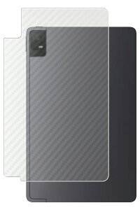 TCL TAB 11 p [10] J[{ NA w ی tB  eB[V[G ^u Cu