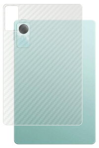 Xiaomi Redmi Pad SE p [10] J[{ NA w ی tB  VI~ bh~[ pbh GXC[