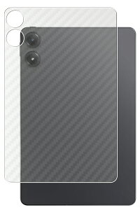 Xiaomi Redmi Pad Pro 2024Nf p [10] J[{ NA w ی tB  VI~ bh~[ pbh v