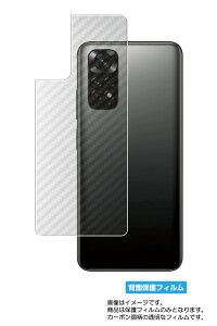 Xiaomi Redmi Note 11 p J[{ NA w یtB 