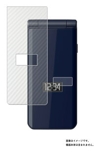 �y2���g(�{�̕\��[�J�[�{����]+�T�u�f�B�X�v���C)�z Fujitsu arrows �P�[�^�C �x�[�V�b�N F-41C docomo �p AR/�}�b�g �n�C�u���b�h ���@�\ ���˒ጸ �ی�t�B���� �{ �J�[�{���� �{�̕\�� �ی�t�B����