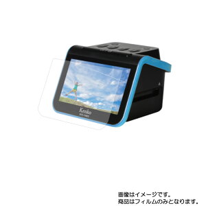 y2ZbgzPR[ Kenko KFS-14WSN py  ڂɗD A`OA u[CgJbg ^Cv zt ی tB  fWJ fW^J J t  ی tB V[