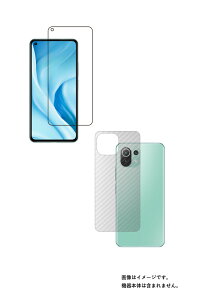 y2g(+w)zXiaomi Mi 11 Lite 5G py dx u[CgJbg NA zt ی tB ɋĖڂɗDI{J[{w ی tB  VI~ GAC Cu 