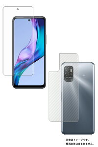 y2g(+w)zXiaomi Redmi Note 10T p R RECX ˖h~ t ی tB { J[{ w یtB  VI~ bh~[ m[g