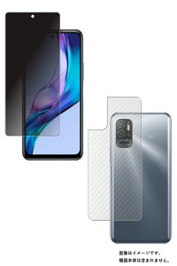 y2g(+w)zXiaomi Redmi Note 10T p ̂h~ vCoV[ی t ی tB { J[{ w یtB  VI~ bh~[ m[g