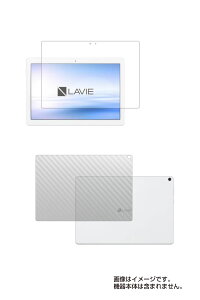 y2g(+w)zNEC LAVIE Tab E TE710/KAW p [10]y @\ ˖h~ X[X^b` / R zt ی tB{J[{wʕیtB  ^ubg ^ubgPC t  ی t