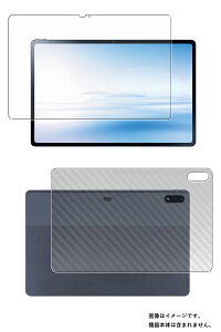 y2g(+w)zNEC LAVIE Tab T12 PC-T1295DAS p [N30] S5@\ Ռz u[Cg Jbg t ی tB { J[{ w یtB ˖h~ R CAX  GkC[V