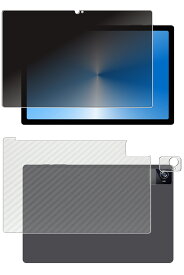 【3枚組(画面+背面+カメラ周辺部)】UAUU T90 / AAUW T90 用 [10] 4way のぞき見防止 プライバシー保護 液晶 保護 フィルム + カーボン調 背面 保護フィルム ★ ユアユー