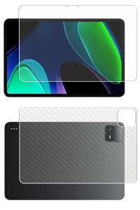 �y2���g(���+�w��)�zXiaomi Pad 6 �p [10] ���S��5��@�\ �Ռ��z�� �u���[���C�g �J�b�g �t�� �ی� �t�B���� �{ �J�[�{���� �w�� �ی�t�B���� ���˖h�~ �R�� �C�A���X �� �V���I�~ �p�b�h �V�b�N