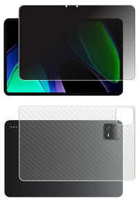 �y2���g(���+�w��)�zXiaomi Pad 6 �p [10] 4way �̂������h�~ �v���C�o�V�[�ی� �t�� �ی� �t�B���� �{ �J�[�{���� �w�� �ی�t�B���� �� �V���I�~ �p�b�h �V�b�N�X