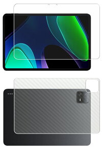 �y2���g(���+�w��)�zXiaomi Pad 6 �p [10] ������ ���ׂ��׃^�b�` �R�� �N���A �^�C�v �t�� �ی� �t�B���� �{ �J�[�{���� �w�� �ی�t�B���� �� �V���I�~ �p�b�h �V�b�N�X