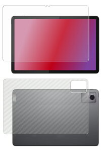 �y2���g(���+�w��)�zLenovo Tab M11 10.95�C���` 2024�N���f�� �p [10] AR/�}�b�g �n�C�u���b�h ���@�\ ���˒ጸ �ی�t�B���� �{ �J�[�{���� �w�� �ی�t�B���� �� ���m�{�E�W���p�� �^�u �G���C���u