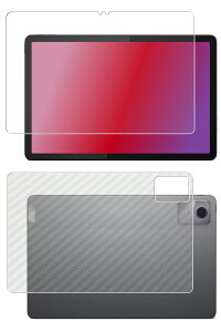 �y2���g(���+�w��)�zLenovo Tab M11 10.95�C���` 2024�N���f�� �p [10] �h�w�� �N���A �^�C�v �t�� �ی� �t�B���� �{ �J�[�{���� �w�� �ی�t�B���� �� ���m�{�E�W���p�� �^�u �G���C���u��