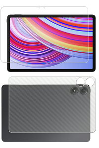 yX[p[SALE zy2g(+w)zXiaomi Redmi Pad Pro 2024Nf p [10] hw NA ^Cv t ی tB { J[{ w یtB 