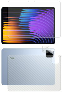 y2g(+w)zXiaomi Pad 7 / 7 Pro p [10]  ڂɗD A`OA u[Cg Jbg ^Cv t ی tB { J[{ w یtB  VI~ pbh Zu v