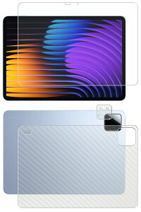 y2g(+w)zXiaomi Pad 7 / 7 Pro p [10]  ׂ׃^b` R NA ^Cv t ی tB { J[{ w یtB  VI~ pbh Zu v