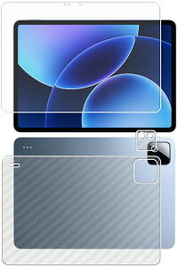 �y2���g(���+�w��)�zXiaomi Pad 8 / 8 Pro �p [10] �}�b�g ���˒ጸ �^�C�v �t�� �ی� �t�B���� �{ �J�[�{���� �w�� �ی�t�B���� �� �V���I�~ �p�b�h �G�C�g �v��